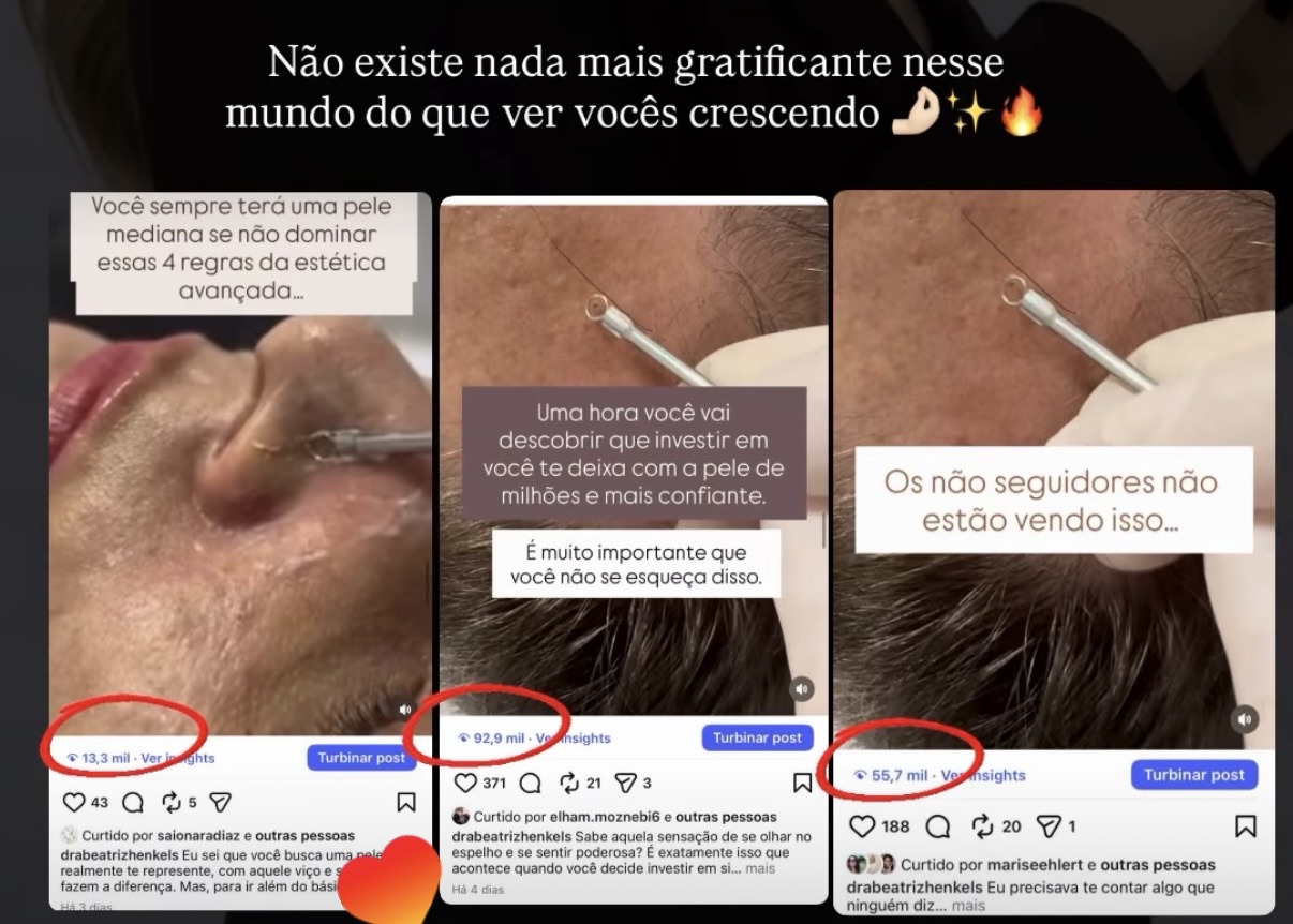 Prints de insights com 13, 55 e 92 mil visualizações
